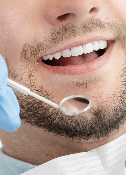 Treatment - Wine Street Dental