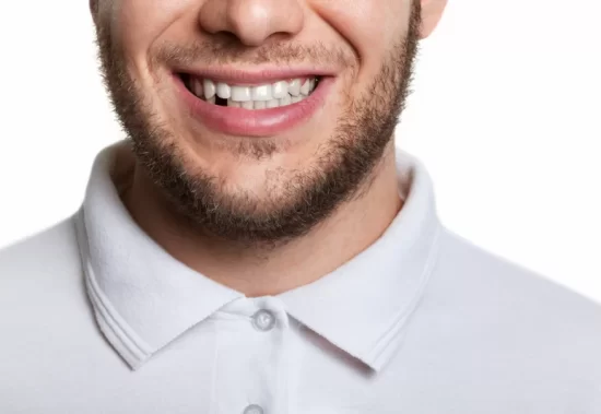 Blog - Wine Street Dental