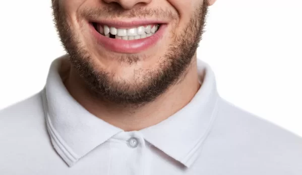 Wine Street Dental blog-inner