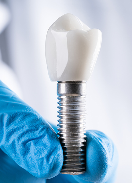 Treatment - Wine Street Dental