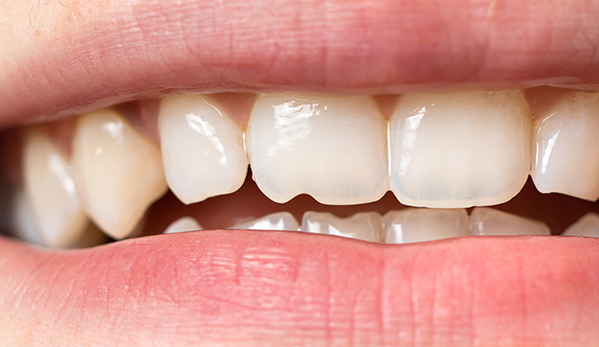 Wine Street Dental blog-inner