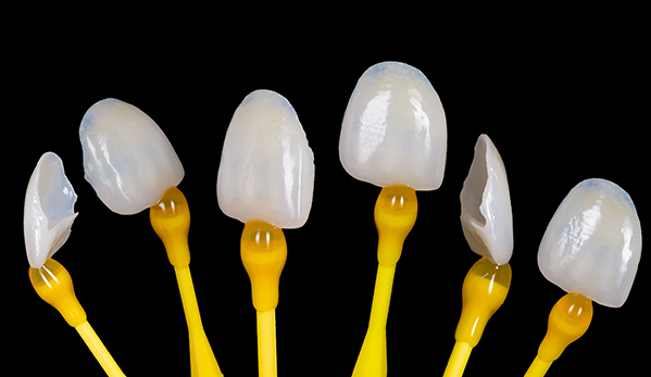 Wine Street Dental blog-inner