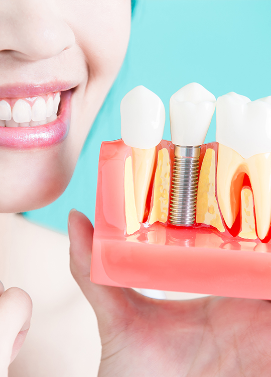 Treatment - Wine Street Dental